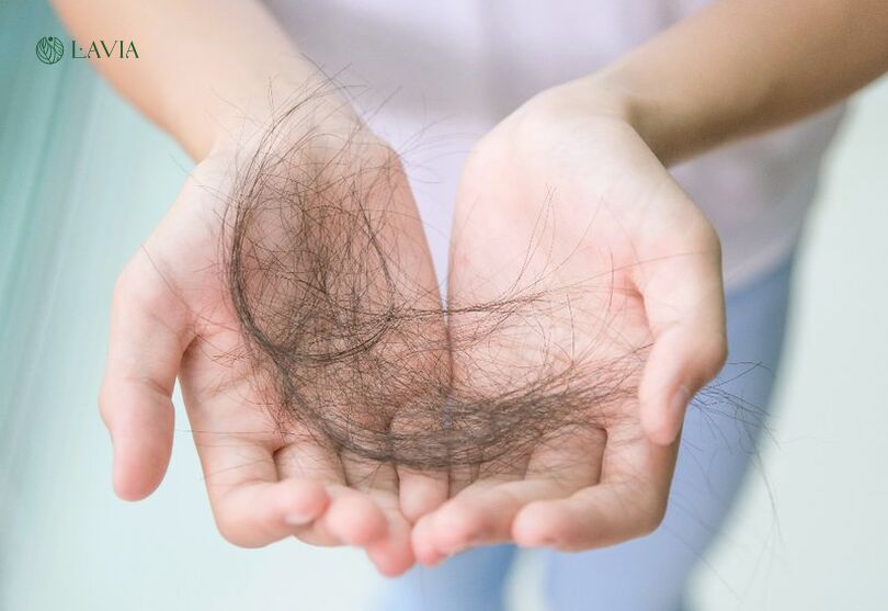 Bí quyết chiến thắng "nỗi ám ảnh" tóc rụng
