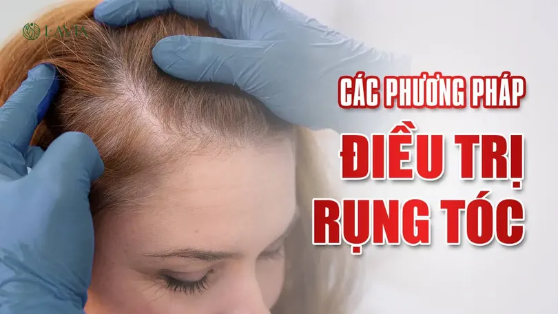 Phương pháp điều trị rụng tóc hiệu quả cho nữ tuổi 17