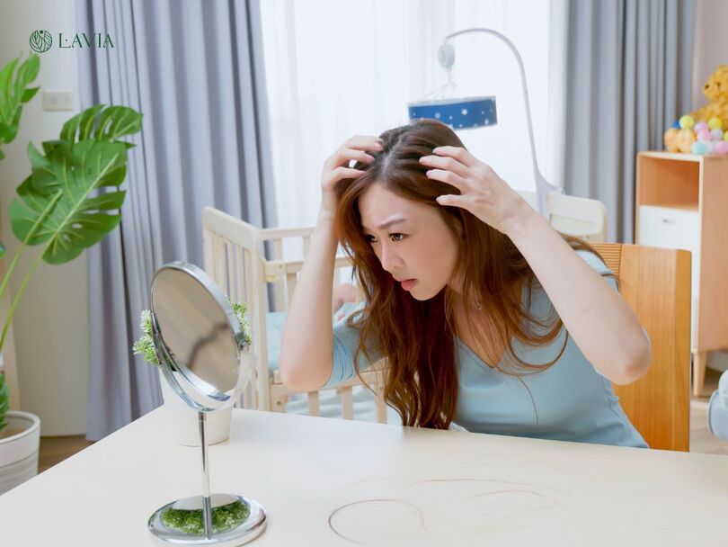 Sau sinh rụng tóc nhiều có sao không?