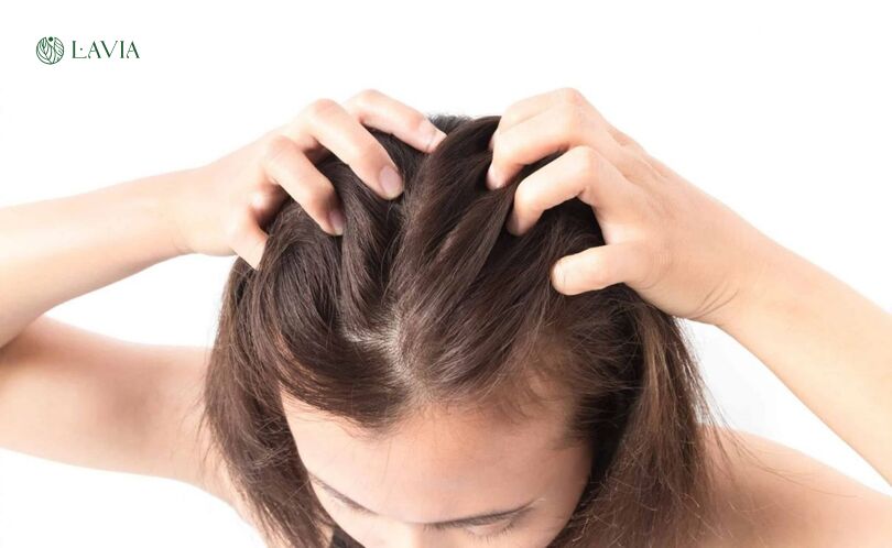 2. Các tiêu chí để chọn dầu gội trị rụng tóc sau sinh